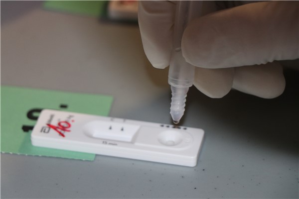 Zpracování antigenního test na vir SARS CoV-2. Foto: KZ, a. s./Petr Sochůrek