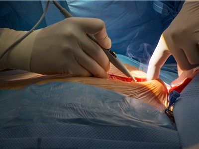 Kardiochirurgie bude mít v ústecké Masarykově nemocnici vyčleněny pro operace od září dva dny v týdnu
