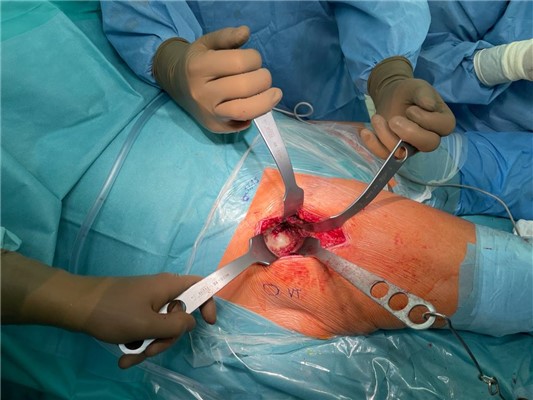 Snímek z operace.