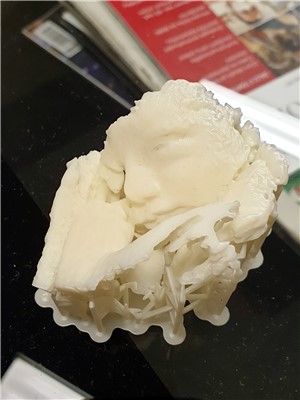 3D model nenarozeného plodu mohou nyní nabídnout maminkám na gynekologicko-porodnickém oddělení děčínské nemocnice. Foto: Krajská zdravotní, a.s.