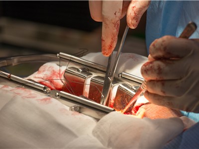 Úspěšné kardiochirurgické operace posouvají Krajskou zdravotní blíž k cíli - získání statutu komplexního kardiovaskulárního centra